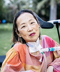 Alice Wong